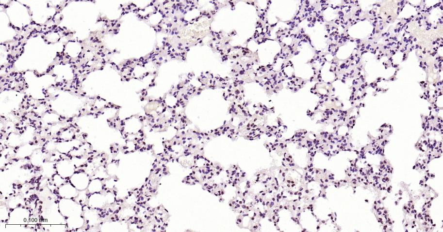 磷酸化信号转导和转录激活因子3抗体-bs-22386R