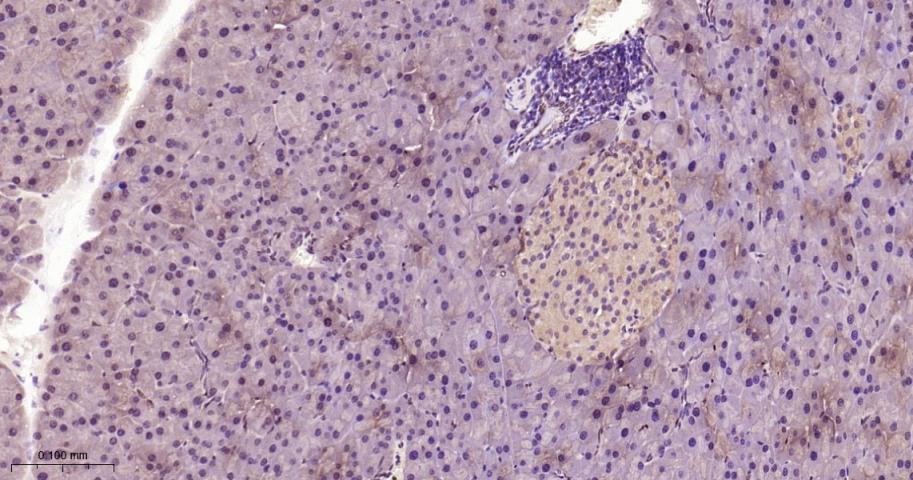 信号转导和转录激活因子3抗体-bs-20382R