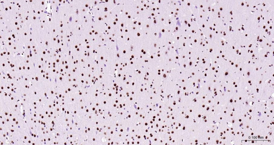 磷酸化RNA聚合酶II CTD重组兔单抗