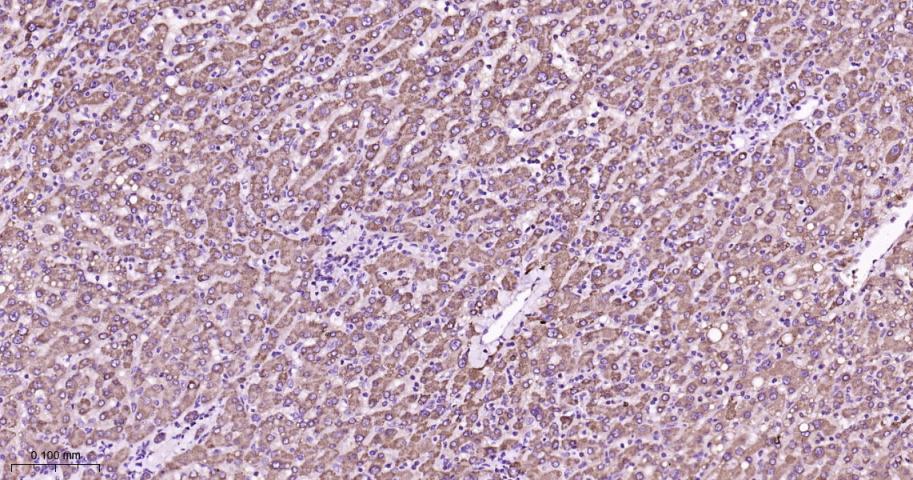 蛋白激酶C α重组兔单抗