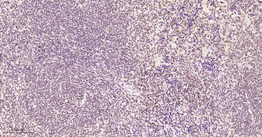 磷酸化细胞肿瘤抗原P53抗体-bs-3705R