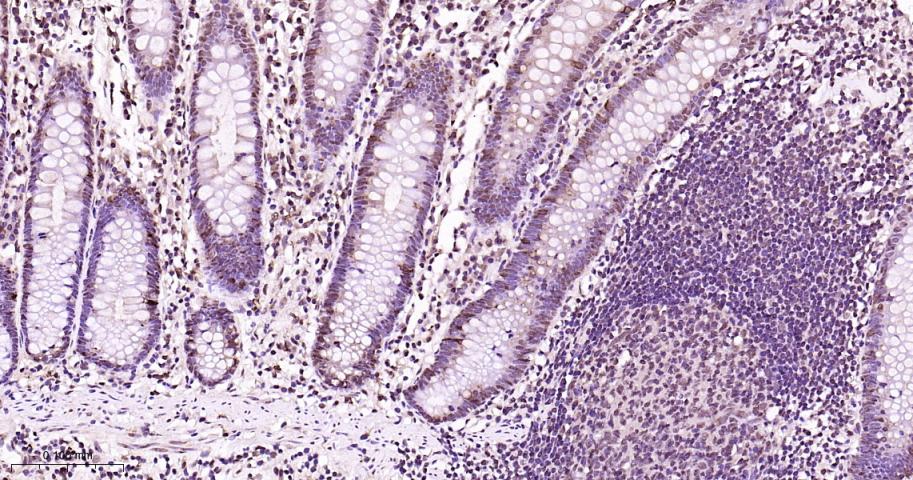 异染色质蛋白1-γ/HP-1γ重组兔单抗-bsm-61603R