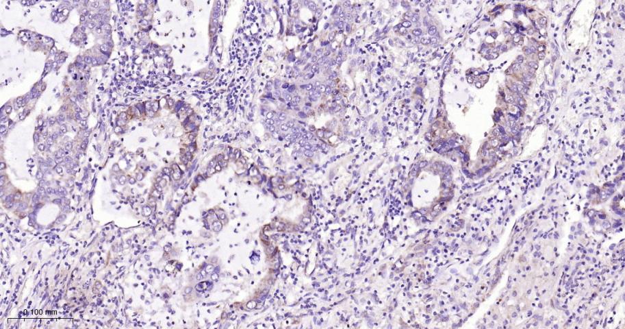 信号转导和转录激活因子3单克隆抗体-bsm-33223M