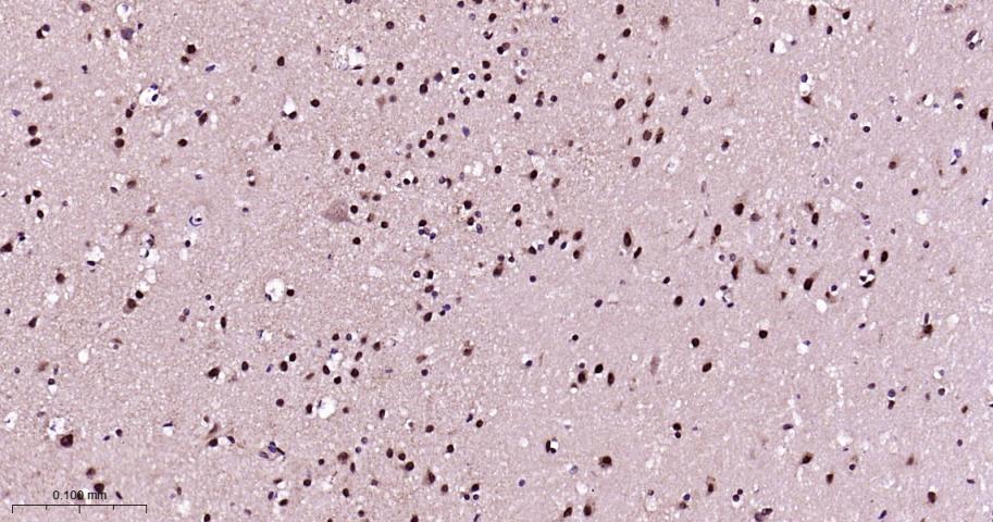 异染色质蛋白1-γ/HP-1γ重组兔单抗-bsm-61603R