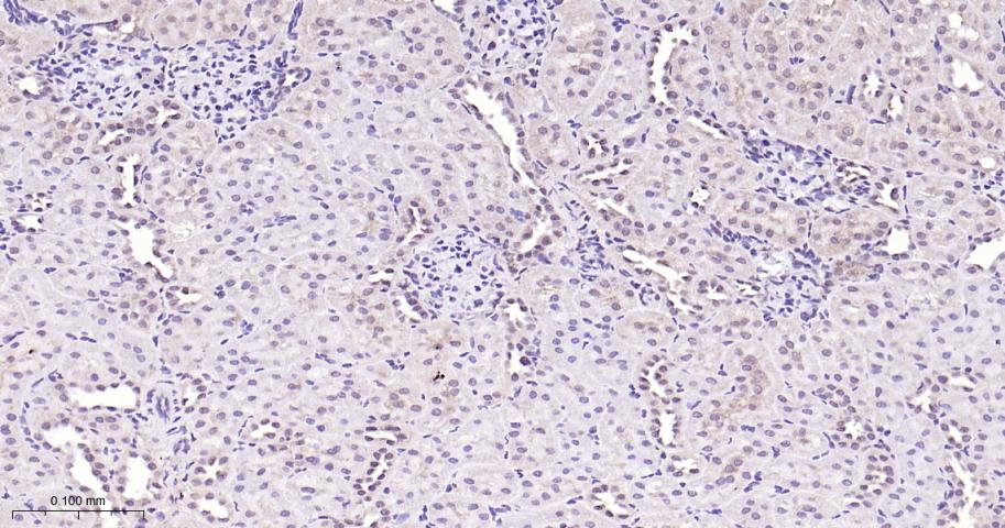 NADPH氧化酶4抗体