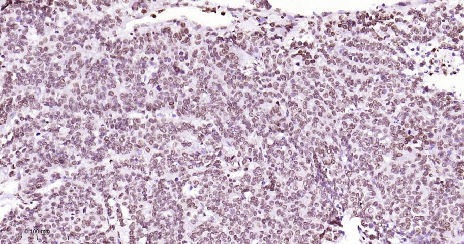 磷酸化细胞肿瘤抗原P53抗体-bs-3705R