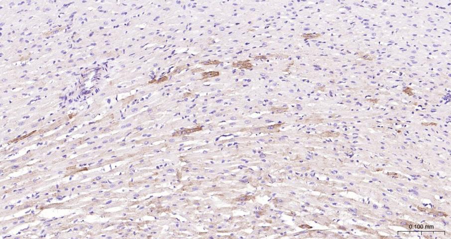 蛋白酶激活受体-2重组兔单抗