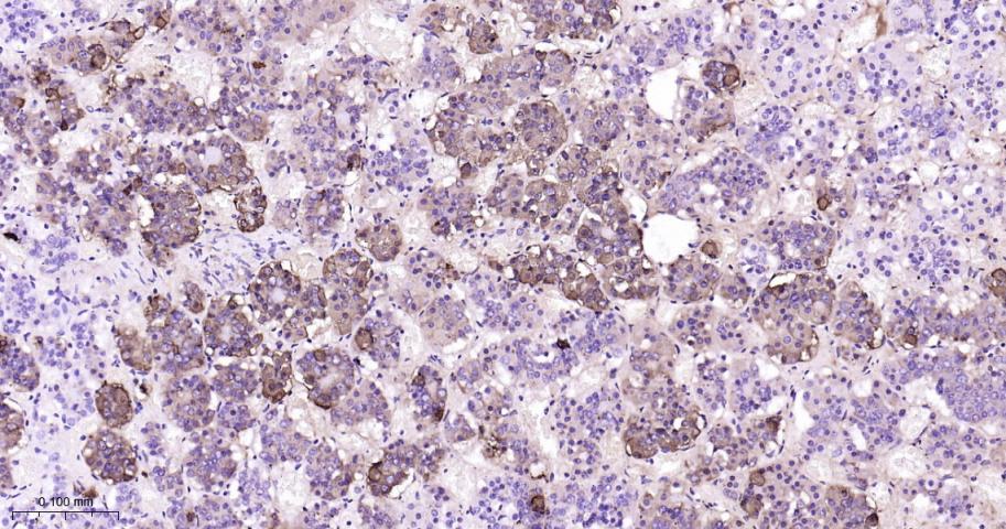 促肾上腺皮质激素重组兔单克隆抗体