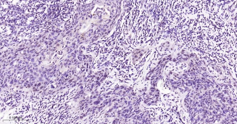 磷酸化信号转导和转录激活因子3抗体-bs-22386R
