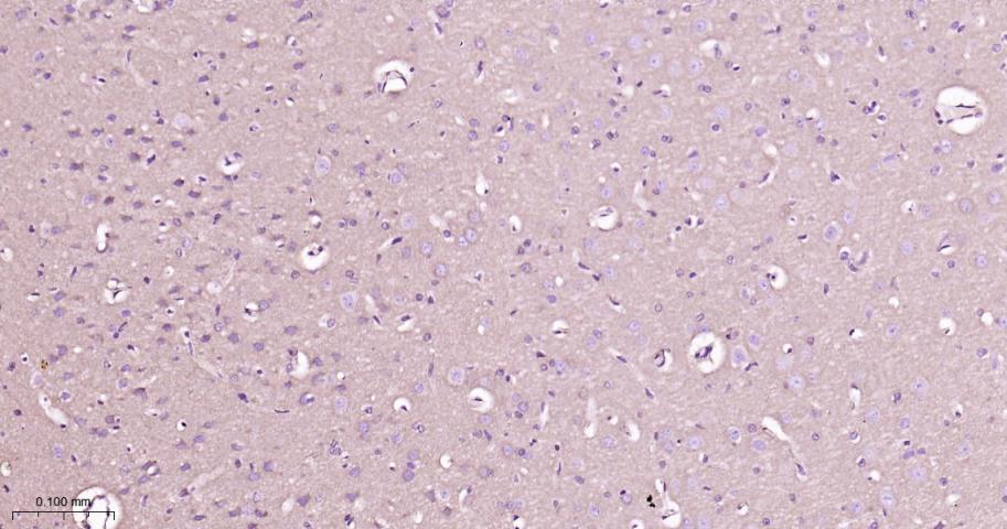 蛋白激酶C α重组兔单抗