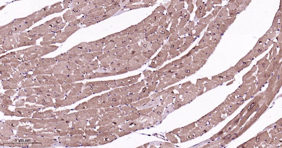 蛋白酶调解因子14重组兔单抗