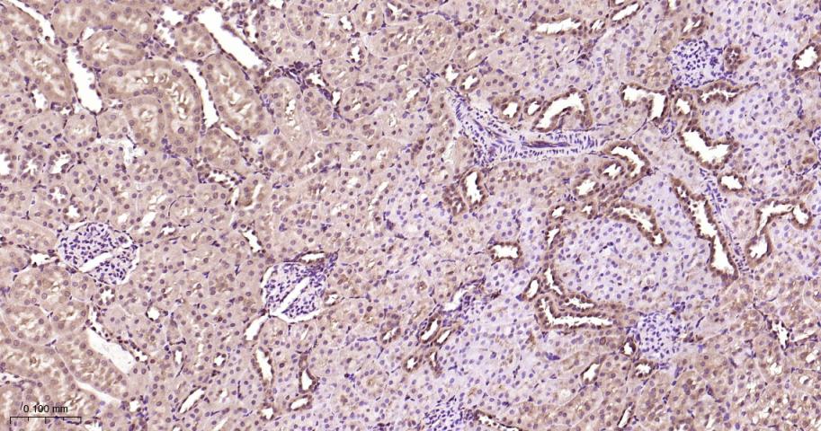 丝裂原活化蛋白激酶1/ERK 1/2重组兔单抗