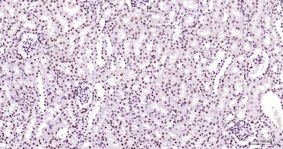 磷酸化RNA聚合酶II CTD重组兔单抗