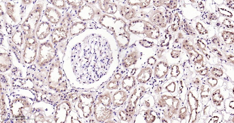 NADPH氧化酶4抗体