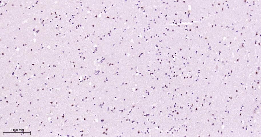 磷酸化MEK1重组兔单抗-bsm-62900R