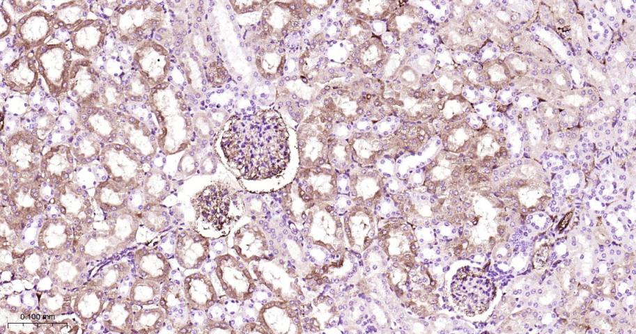 载脂蛋白A1重组兔单抗