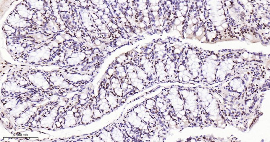 磷酸化p38 MAPK重组兔单抗