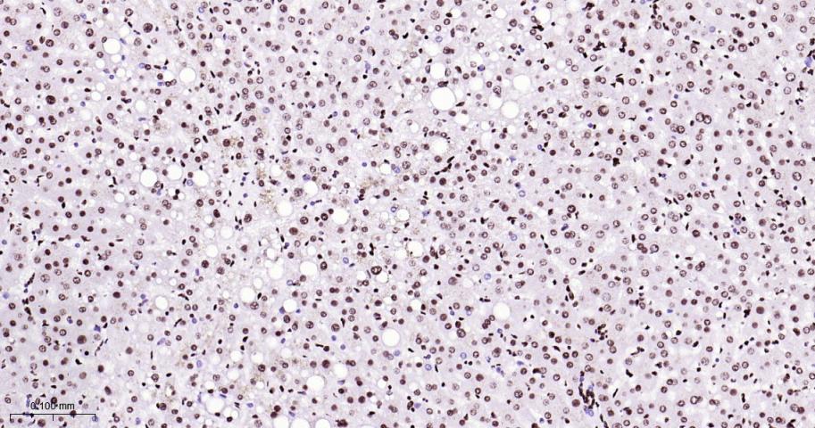 白细胞介素增强子结合因子3重组兔单抗