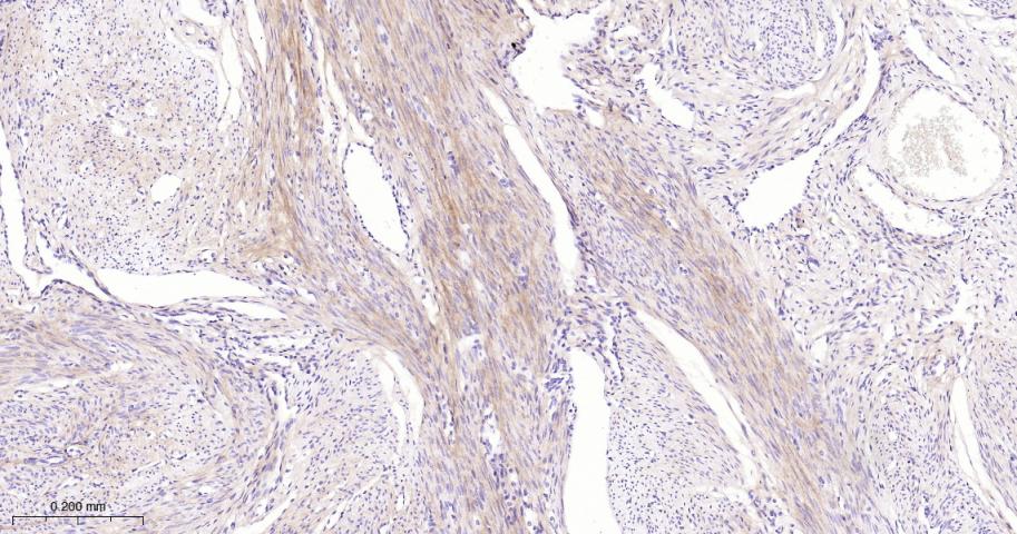 角膜上皮蛋白TGFBI重组兔单抗