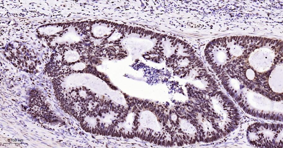 白细胞介素增强子结合因子3重组兔单抗