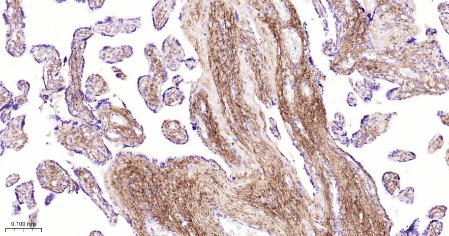 角膜上皮蛋白TGFBI重组兔单抗