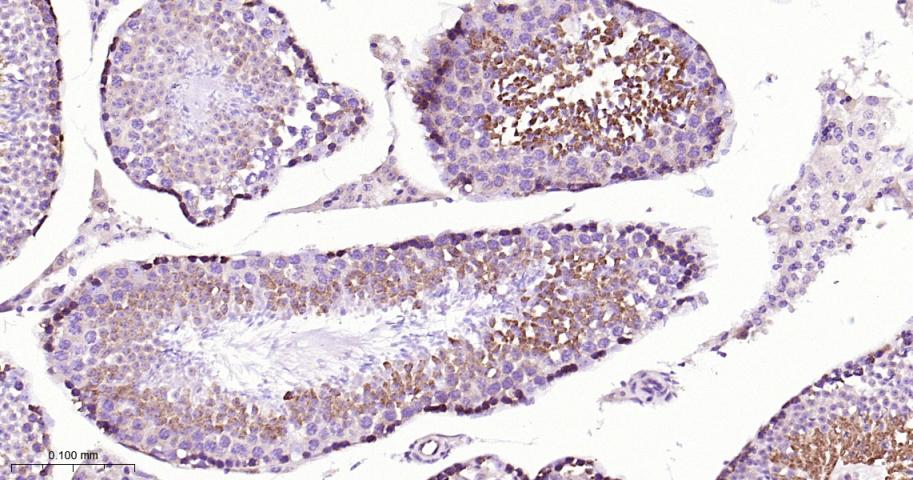 核糖核酸酶L抑制蛋白重组兔单抗