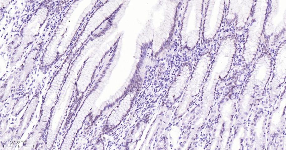 拓普西异构酶Ⅰ重组兔单抗