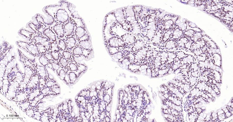 白细胞介素增强子结合因子3重组兔单抗
