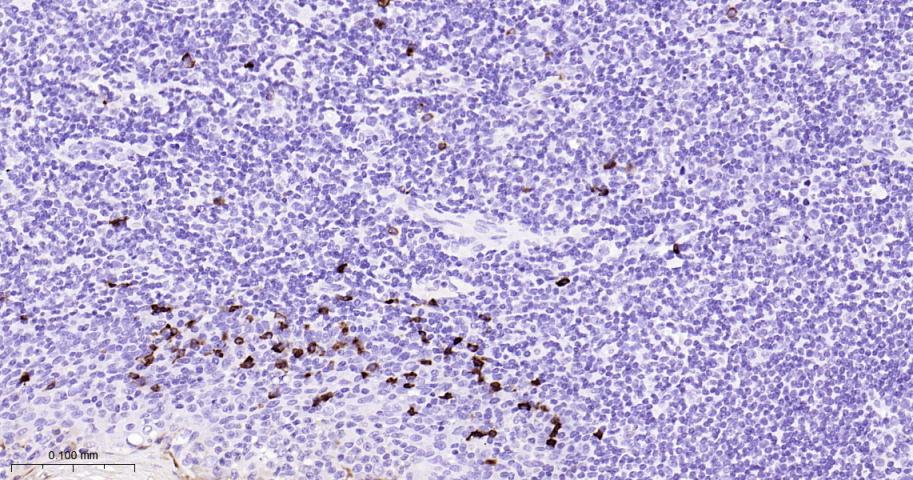 人免疫球蛋白A重组兔单抗