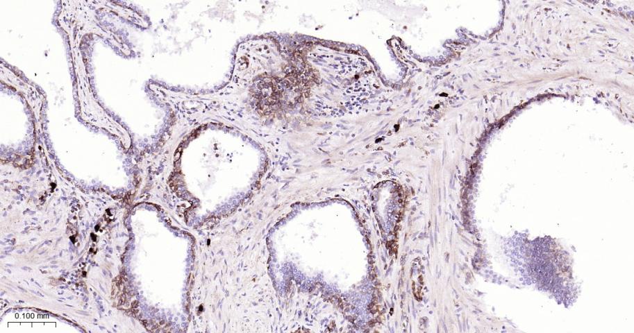 跨膜蛋白173重组兔单抗