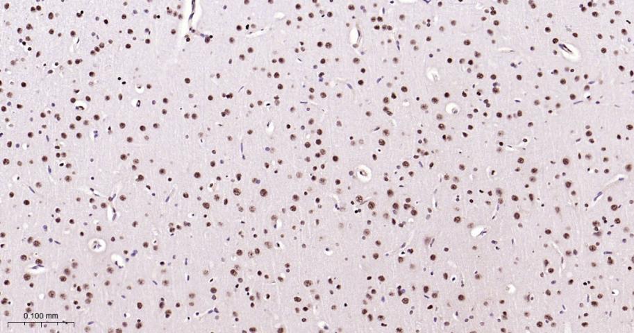 磷酸化p38 MAPK重组兔单抗