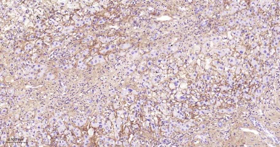 角膜上皮蛋白TGFBI重组兔单抗