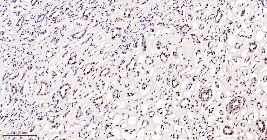 磷酸化p38 MAPK重组兔单抗