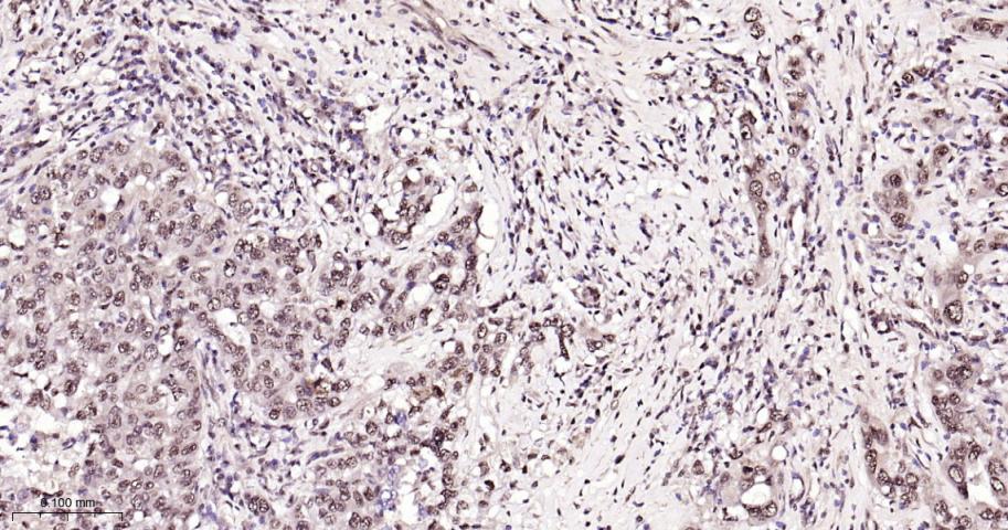 磷酸化p38 MAPK重组兔单抗