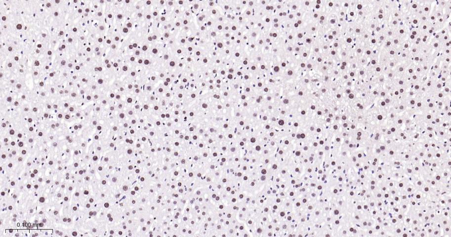 磷酸化p38 MAPK重组兔单抗