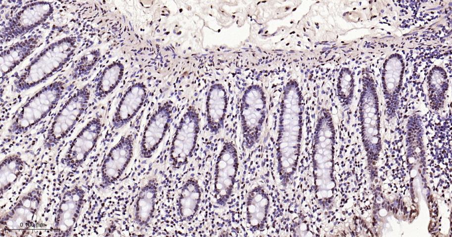 磷酸化p38 MAPK重组兔单抗