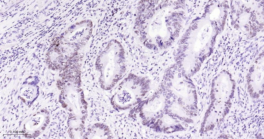 拓普西异构酶Ⅰ重组兔单抗