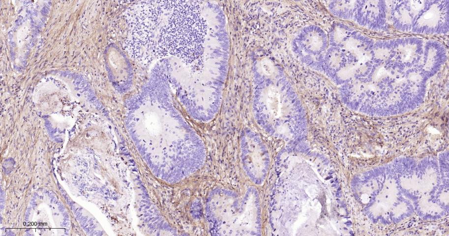 角膜上皮蛋白TGFBI重组兔单抗