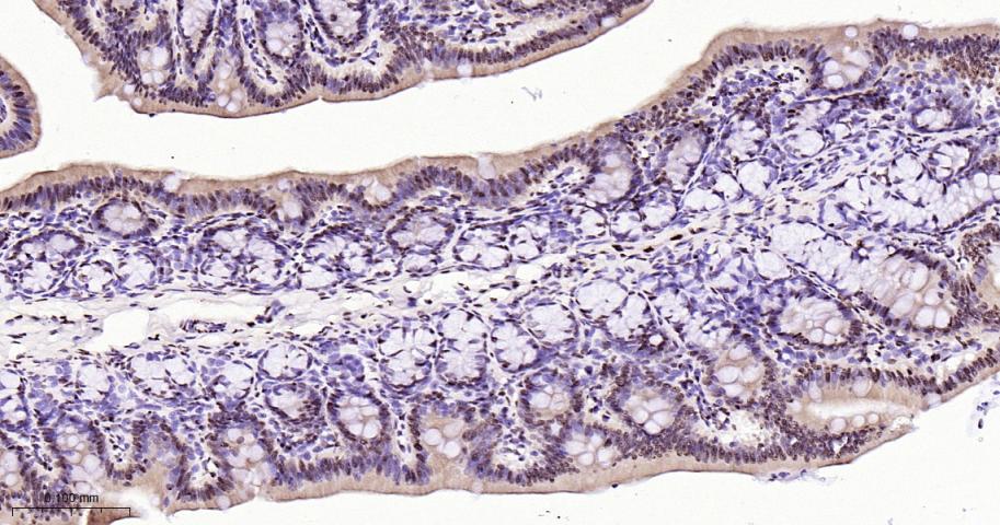 磷酸化p38 MAPK重组兔单抗