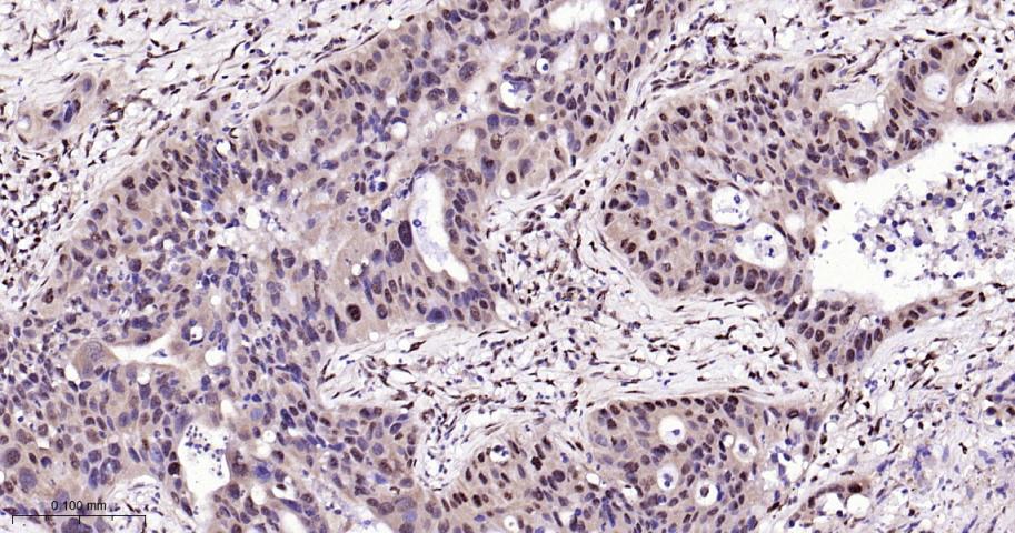 磷酸化p38 MAPK重组兔单抗