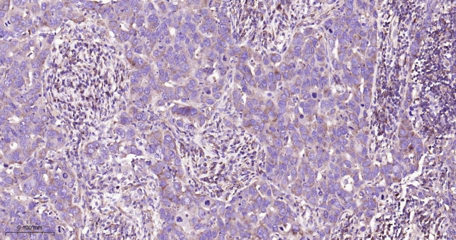 核糖核酸酶L抑制蛋白重组兔单抗