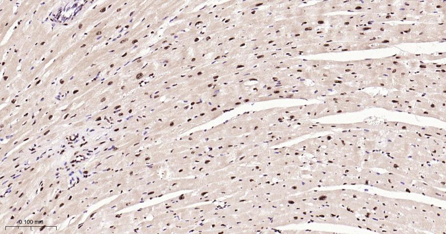 磷酸化p38 MAPK重组兔单抗
