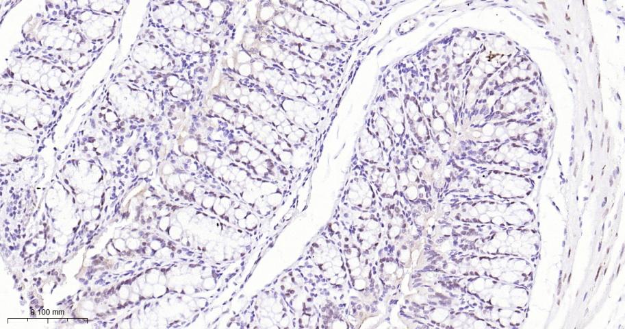 叉头蛋白P1重组兔单抗
