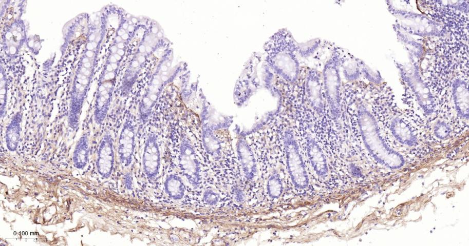 角膜上皮蛋白TGFBI重组兔单抗