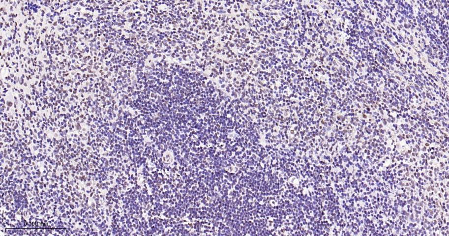 磷酸化p38 MAPK重组兔单抗