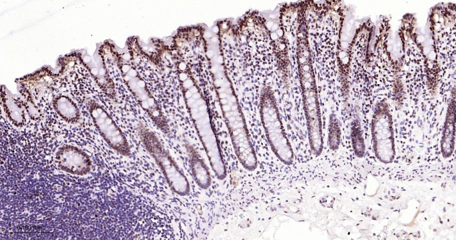 拓普西异构酶Ⅰ重组兔单抗