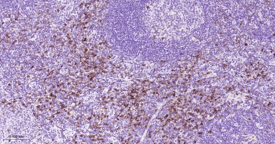 CD134重组兔单抗