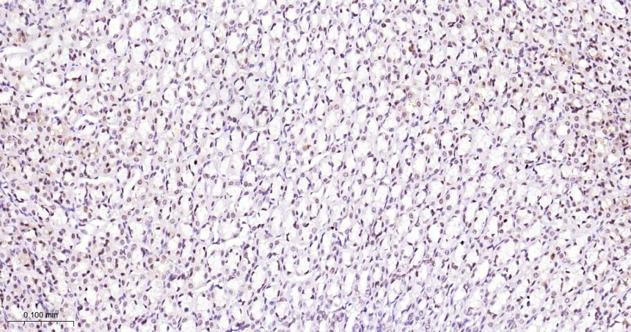 拓普西异构酶Ⅰ重组兔单抗