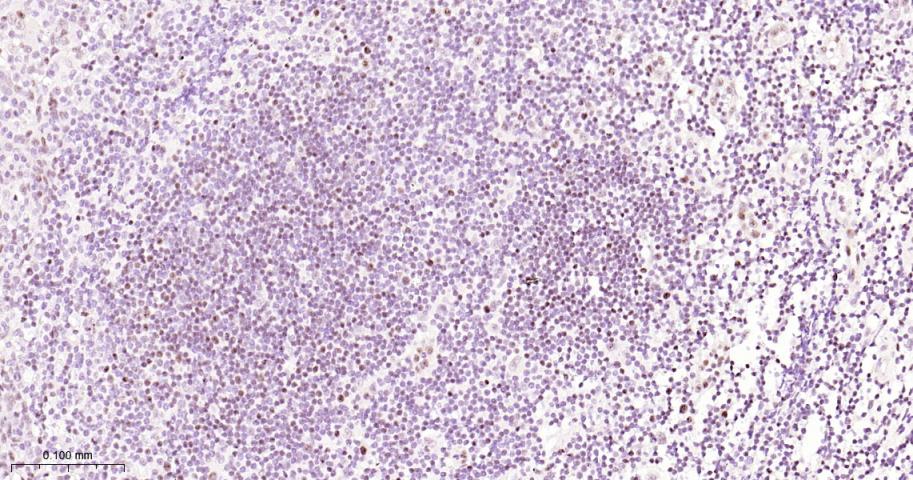 叉头蛋白P1重组兔单抗