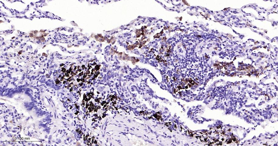 抗酒石酸酸性磷酸酶5型/5型酸性磷酸酶重组兔单抗
